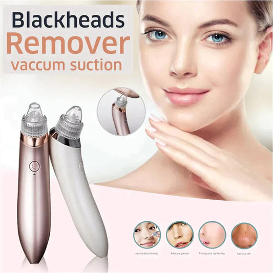 Blackhead Extractor Device: DermaSuction™ with Cell Operation for Blackhead Removal